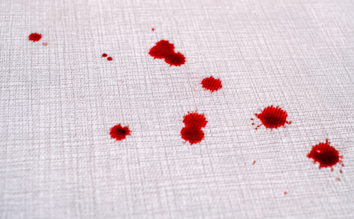 How to Remove Blood Stains